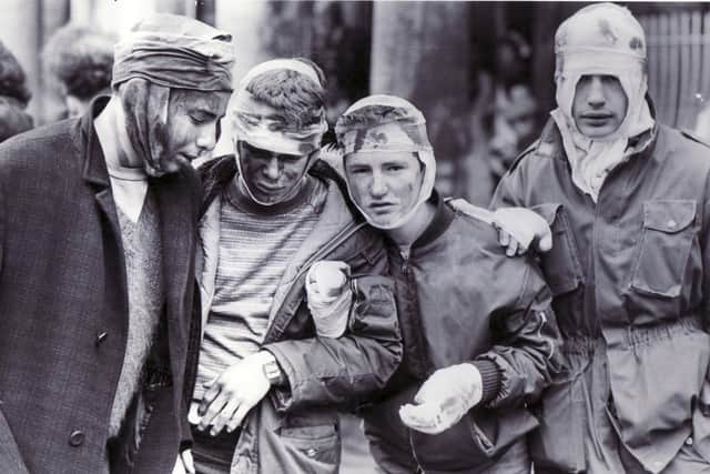 Threads won four BAFTAs and is renowned for its brutal and realistic portrayal of a nuclear fallout.