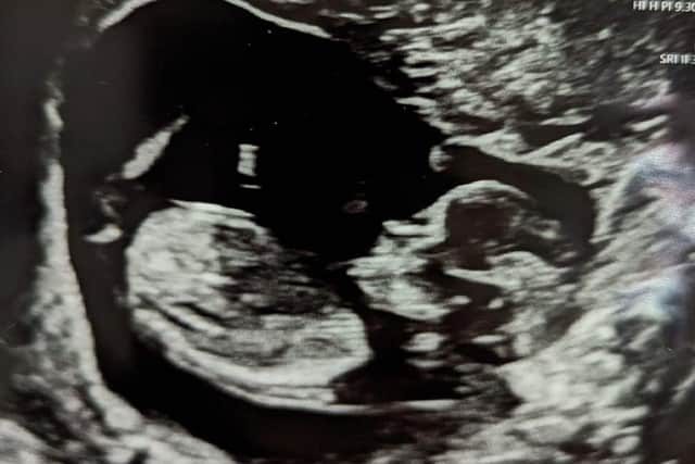 The baby scan Married at First Sight couple Michelle Walder and Owen Jenkins shared when they announced they were expecting their first child together. The baby is due in December. Photo: mafs_owenandmichelle via Instagram