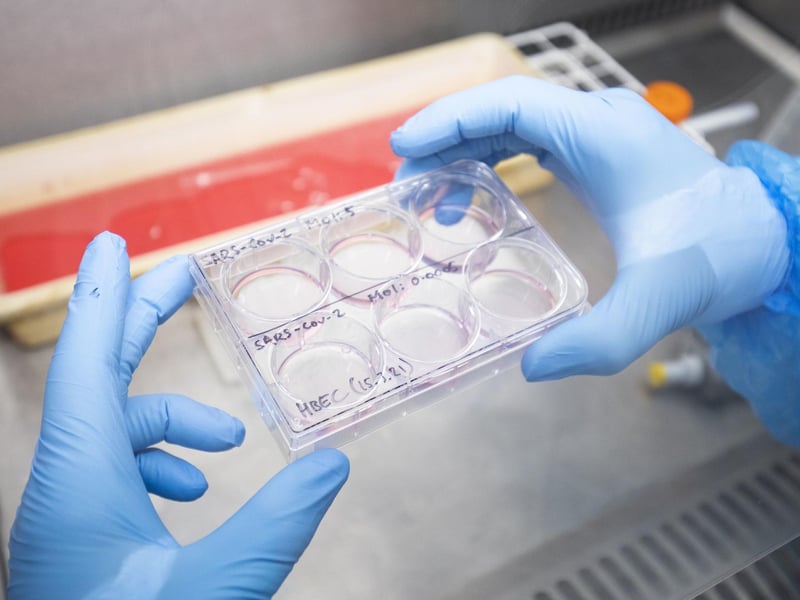 Dr Kieran Dee works in a Class II Microbiological Safety Cabinet with a sample of cultured cells that have been infected with SARS-CoV-2, the virus which causes COVID-19, to determine the genetic makeup of the virus,