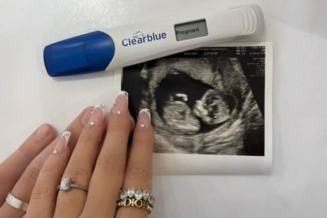 Anel Ahmedhodzic shared this photo as he announced the exciting news that he and his partner are expecting a baby together. Photo: anel.ahmedhodzic/Instagram