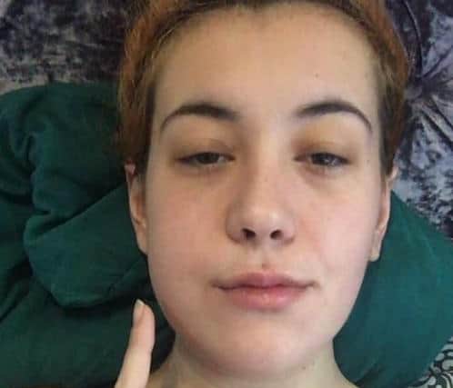 Jordan Del’Nero, from Westfield, Sheffield, after undergoing surgery for mouth cancer. She has secured a settlement from Sheffield Teaching Hospitals after her 'urgent' case was classified as a new 'routine' appointment