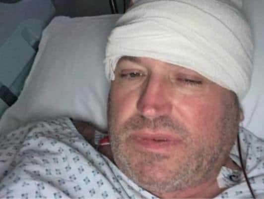 Sheffield dad Dave Whitford is hoping pioneering treatment in America could save his life after a suspected ear infection turned out to be a brain tumour. He is pictured during his time in hospital
