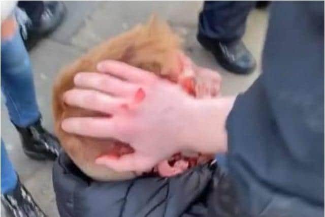 A Sheffield Wednesday fan was left bleeding after he was struck over the head by a police officer with a baton