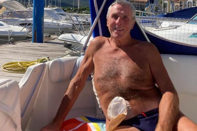 Some people have pet names for loved ones. But for Sheffield cancer survivor Kevin Philliskirk, it’s the urostomy bag he had fitted to catch his urine after he had life saving cancer survery, affectionately called Paloma the Stoma.