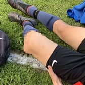 Neil's son, Lucas dislocated his knee during a football game on May 27. Picture by Neil Asquith.
