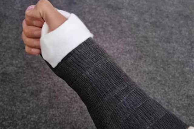 Anthony Tomlinson broke his wrist just 15 minutes before his latest fight - but still got the win.
