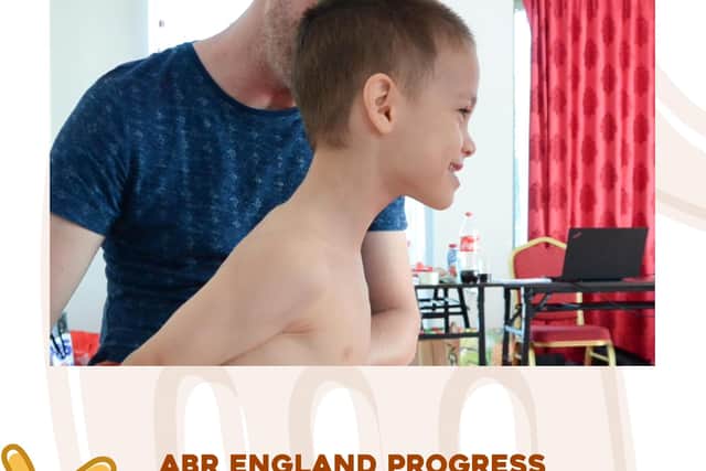 ABR Therapy helps children with brain injuries and other physical disorders.