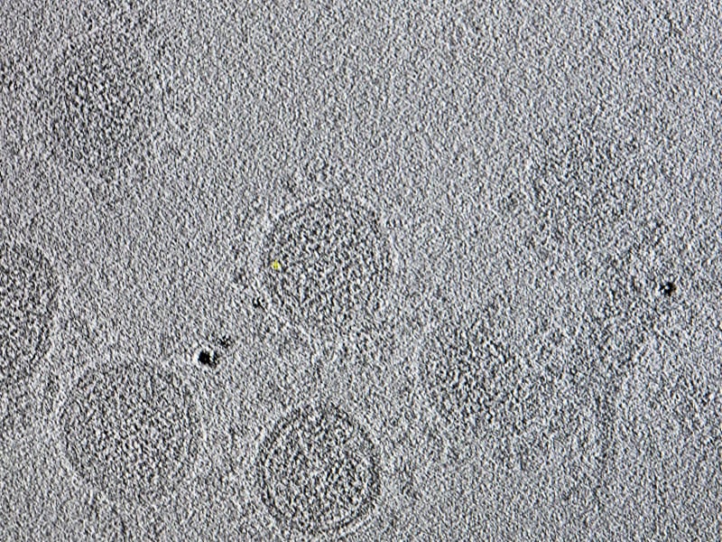 An electron microscope image of SARS-CoV-2 particles created at the MRC-University of Glasgow Centre for Virus Research.