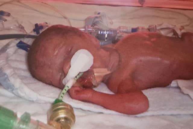 This is Thomas Newton – born weighing just two pounds after an emergency caesarian at the Jessop Wing, Sheffield.