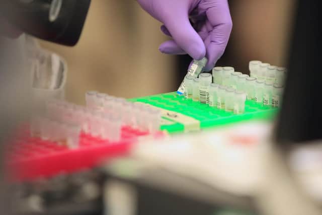 Samples are tested for respiratory viruses (Photo by DANNY LAWSON/POOL/AFP via Getty Images)