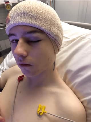Jake Tindale during treatment at Sheffield Children's Hospital