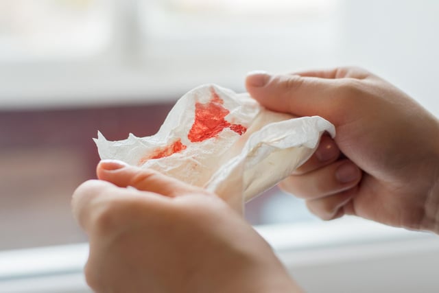 Unexplained bleeding is another common sign associated with cancer. It can include blood in urine, vaginal bleeding between periods, blood from bottom, in your vomit or when you cough. If you notice any of these symptoms, you should seek medical advice.