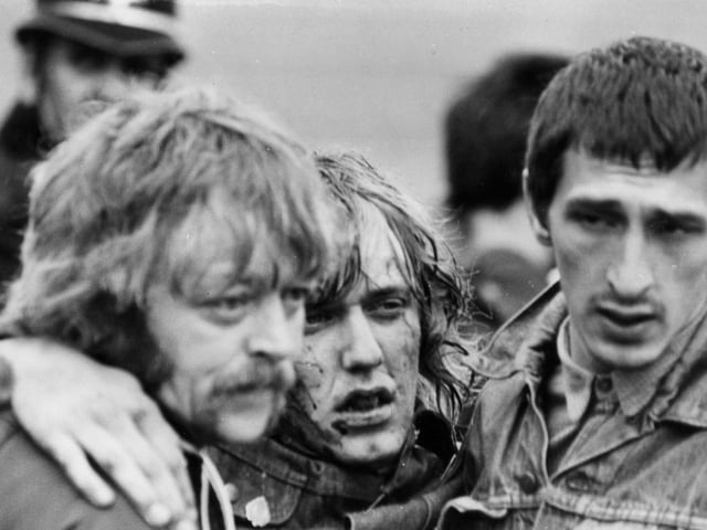 An injured picket is assisted by two of his friends