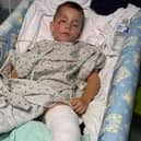 Harrison Martin spent five days in Sheffield Children's Hospital after being hit by a car outside his school