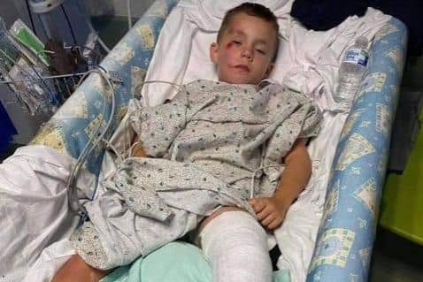 Harrison Martin spent five days in Sheffield Children's Hospital after being hit by a car outside his school
