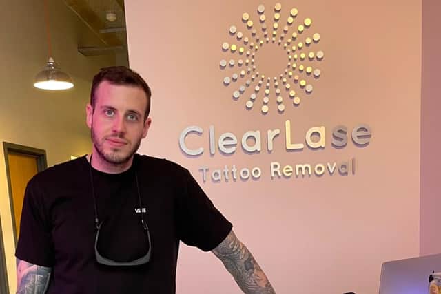 Ben Hartley, founder of ClearLase Tattoo Removal, based on Kelham Square in Sheffield (pic: ClearLase Tattoo Removal)