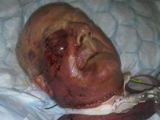 Tommy Ward, aged 80, was the victim of a brutal robbery in his own home