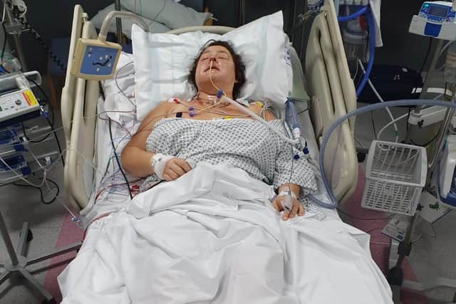 Gill Wood underwent a 13-hour operation at Sheffield's Royal Hallamshire Hospital.
