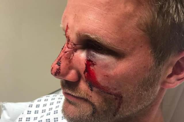PC Dan Lumley was attacked in the line of duty while working for South Yorkshire Police