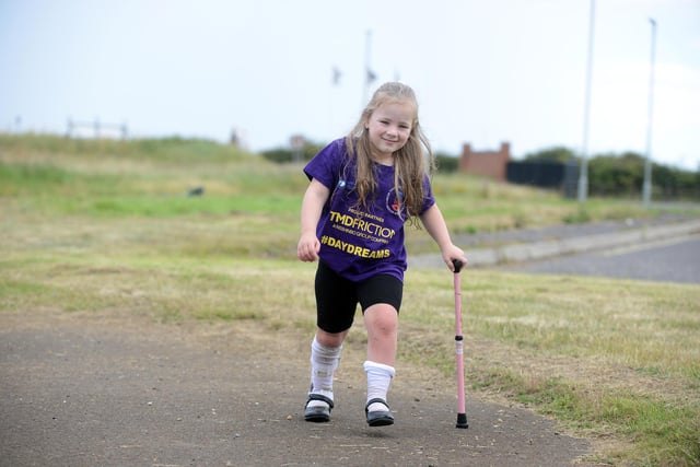 Dottie O'Keefe, six, walking at Miles for Men fun day instead of the annual charity walk following her operation. Picture by Stu Norton.