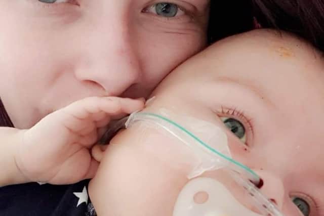 Baby Louie underwent seven operations in his short life