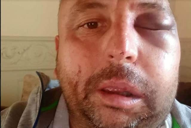 Lee Harris was attacked during an armed raid at his Doncaster home