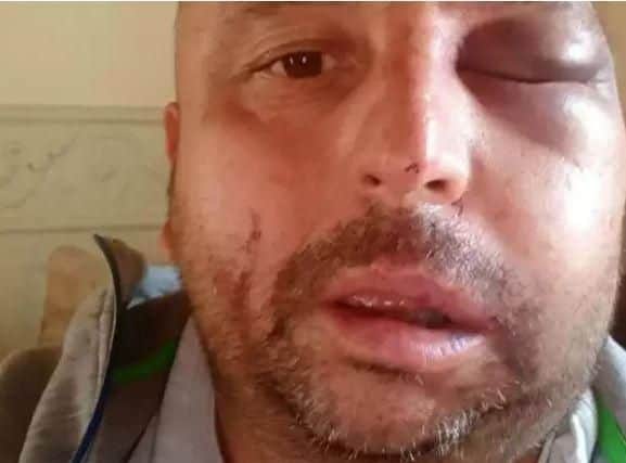 Lee Harris was injured by raiders who burst into his home in Adwick, Doncaster