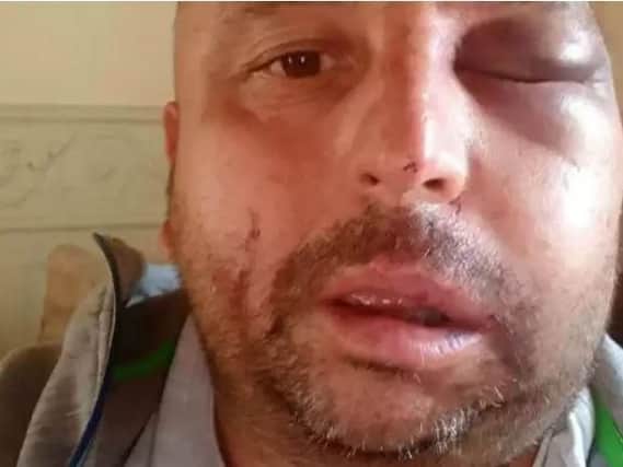Lee Harris was injured by raiders who burst into his home in Adwick, Doncaster