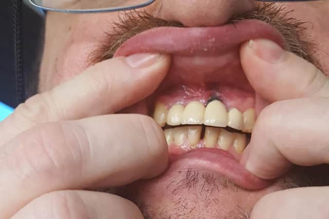 The work carried out on Paul Oxley's teeth