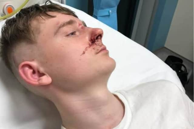 Jack Roberts was hospitalised after an attack in Rotherham