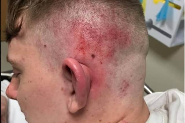 Jack Roberts was attacked in Rotherham last weekend