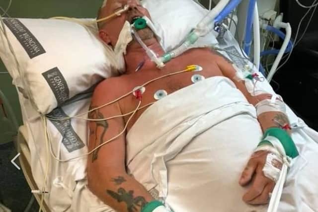 Jimmy was put on life support following the attack in Benidorm