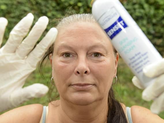 Maxine Jones, who is allergic to water, with her rubber gloves and cleansing foam