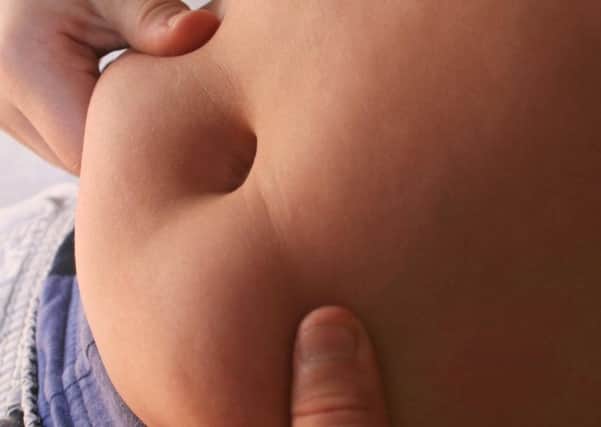 A Generic Photo of close-up view of the stomach of an overweight child. See PA Feature HEALTH Obesity. Picture credit should read: PA Photo/JupiterImages Corporation. WARNING: This picture must only be used to accompany PA Feature HEALTH Obesity. / fat