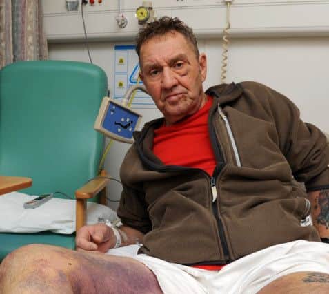 Johnny Chappell in hospital after he was attacked by three men who also killed his dog. Picture: Andrew Roe