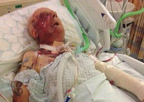 Tommy Ward fighting for his life after the attack