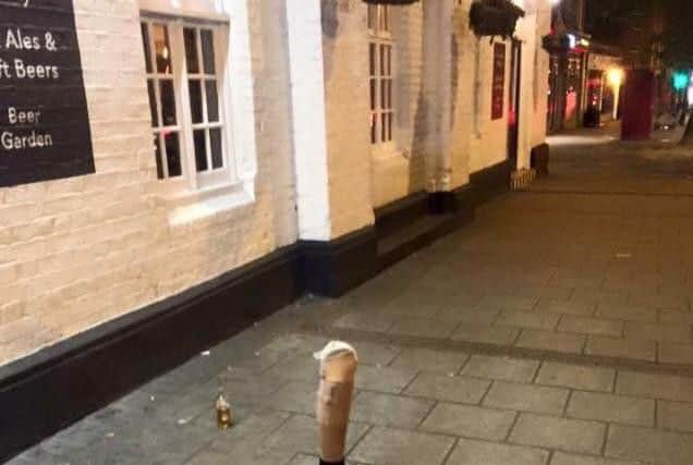 The picture of the lost leg that went viral.