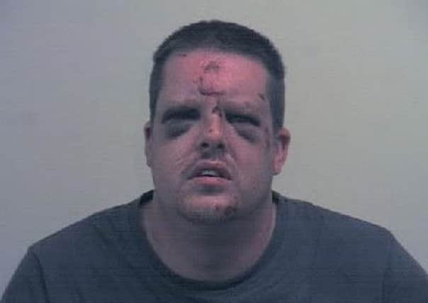 The battered face of sex attacker Johnathon Holmes, who has been jailed for four-and-half years
