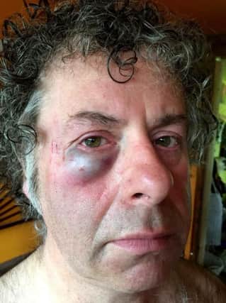 Brian Trevelyan was attacked by a gang of youths on his way home