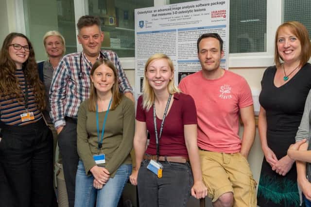 The Sheffield Myeloma Research Team.