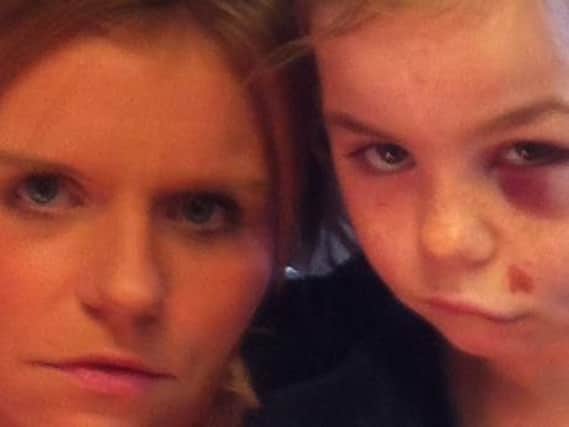 Mum Stephanie Holland with daughter Ebony Dowling, who has caused potentially permanent damage toher left eye after falling on 'dangerous' play equipment.