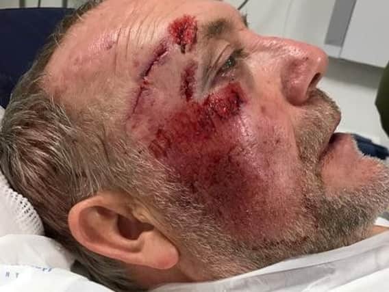 Terry Orwin is lucky to be alive after horror bicycle crash on Sheffield tram tracks.