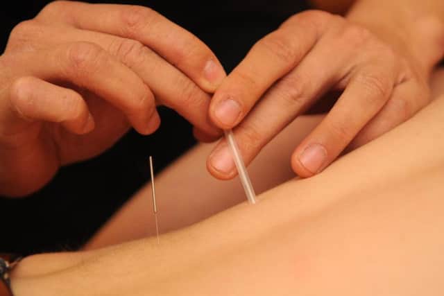 Acupuncture may help with erectile disfunction and premature ejaculation.