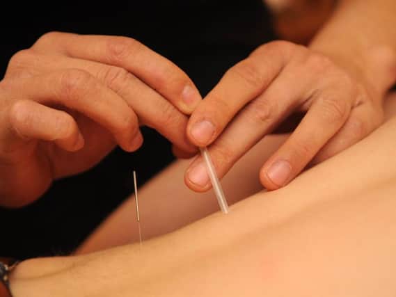 Acupuncture may help with erectile disfunction and premature ejaculation.
