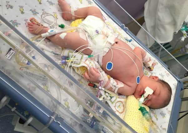 Baby Alfie Mimms, of Rotherham, who was just nine-days-old when he was diagnosed with  meningitis, septicaemia and Group B streptococca. He received treatement at Sheffield Children's Hospital and made a full recovery.