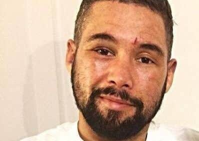 Boxer Tony Bellew