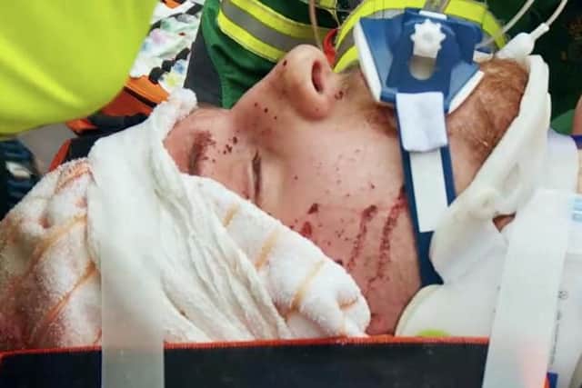 Scott was put in a coma after the horror smash.