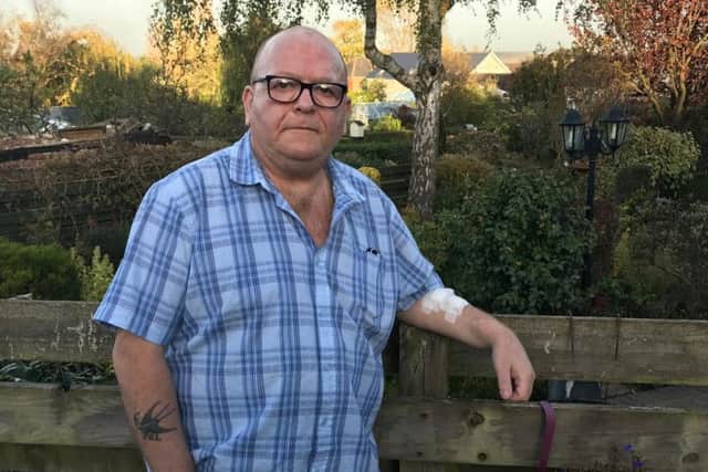 Ian Hill fears 'somebody might die' if continuing delays with kidney dialysis transport is not sorted. Picture: George Torr/The Star