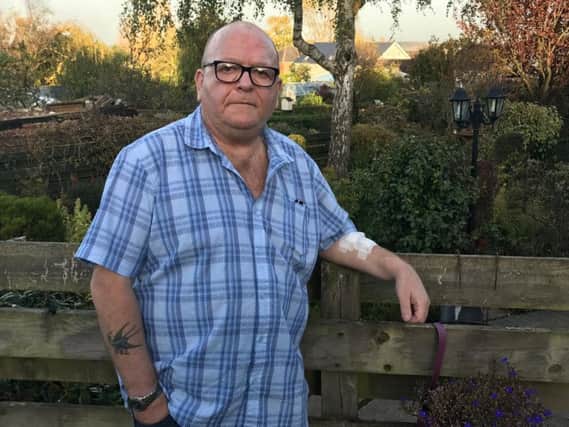 Ian Hill fears 'somebody might die' if continuing delays with kidney dialysis transport is not sorted. Picture: George Torr/The Star