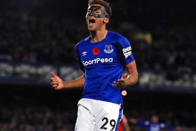 Dominic Calvert-Lewin has scored five times for Everton this season in all competitions